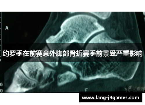 约罗季在前赛意外脚部骨折赛季前景受严重影响